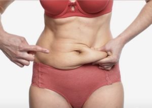 Liposuction in London: 4 Things You Should Know Before Booking