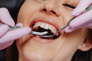 Expert Tips for Overcoming Gum Sensitivity and Gummy Smiles