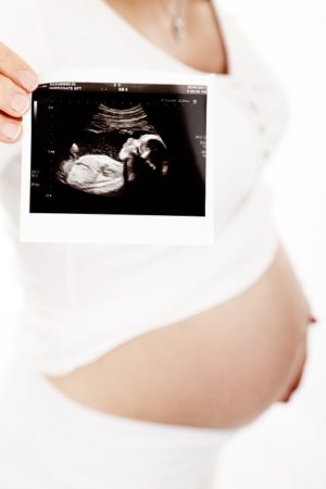 Parents Deserve Free Baby Scan Photos but the NHS Won’t Allow it