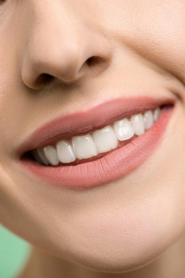 Top Reasons People Choose Turkey for Dental Treatment